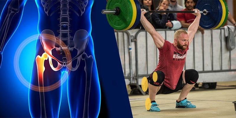 Joint restriction hip mobility