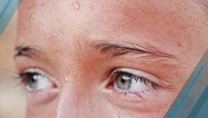 sweaty forehead